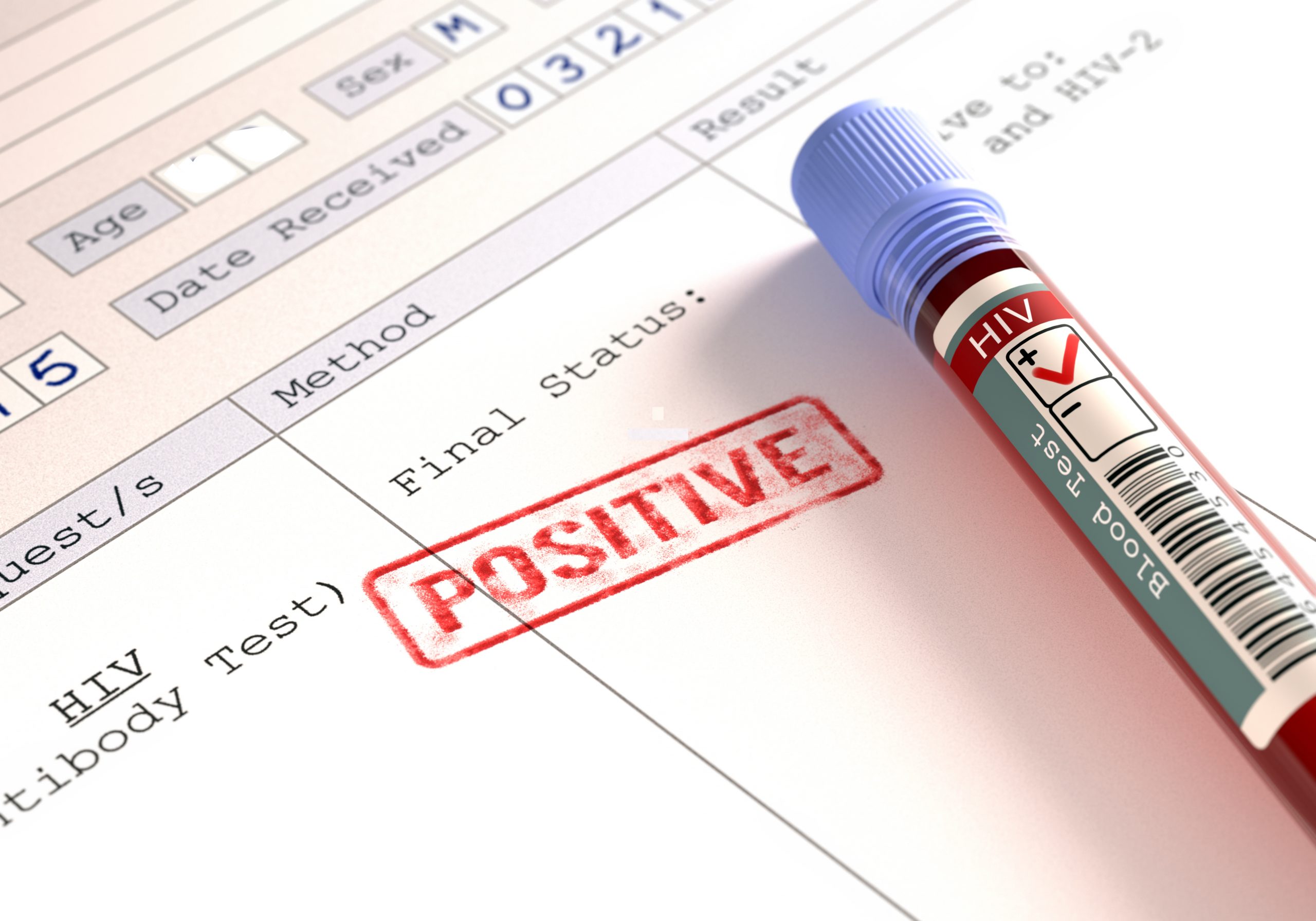 hiv-positive-estado-de-m-xico